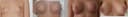 gagge