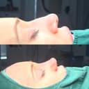 Thumbnail Thumbnail