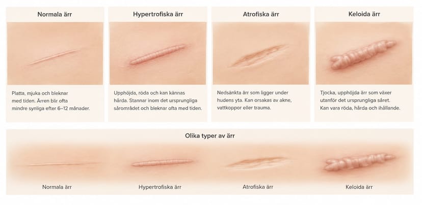 Fula ärr - vad kan man göra?