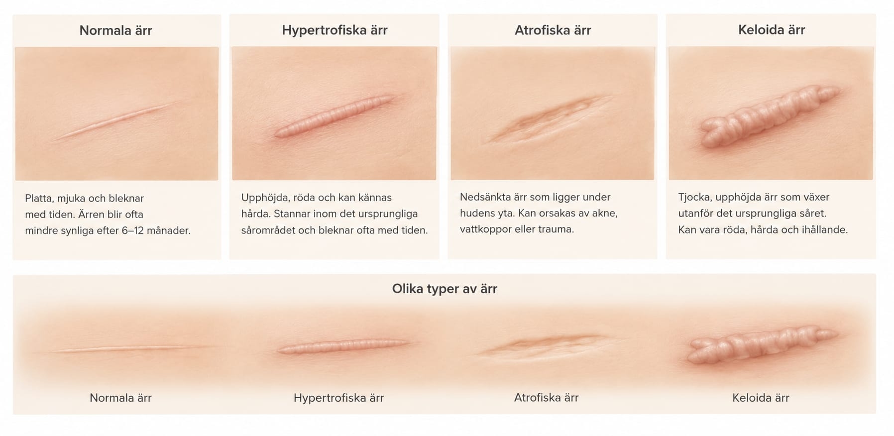 Fula ärr - vad kan man göra?
