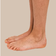 Procedure Image